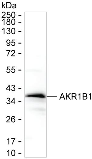 AKR1B1
